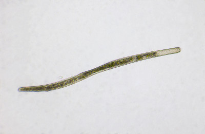 spirostomum.jpg